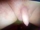 kiskedves35