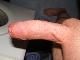 louis1 louis1