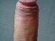 eextreem eextreem