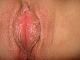 lacid2