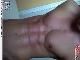tensin