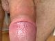 castor1 castor1