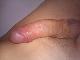 mrxxx mrxxx