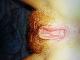Redhead Redhead
