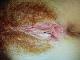 Redhead Redhead
