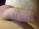 Attisnyalis Attisnyalis