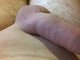 Attisnyalis Attisnyalis