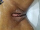 Pelo235 Pelo235