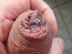 finger