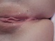 Anonym Anonym