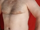 Attisnyalis Attisnyalis