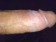 MB0081 MB0081