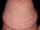 MB0081 MB0081