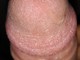 MB0081 MB0081