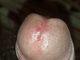 Nivastus Nivastus