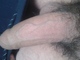 kleiner