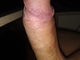 MB0081 MB0081