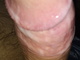 MB00817