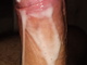 MB00817