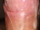 MB00817