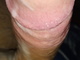 MB00817