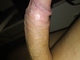MB00817 MB00817