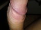 MB00817 albumja