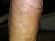 MB00817
