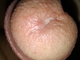 MB00817