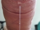 MB00817
