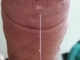 MB00817