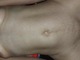 Nicolecum